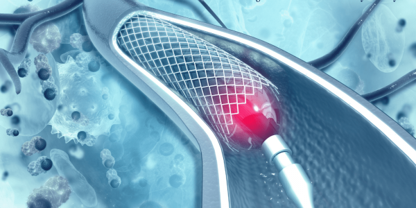 Khung Giá Đỡ Mạch Vành Phủ Thuốc Sirolimus 