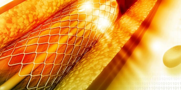 Khung Giá Đỡ Mạch Ngoại Vi Tự Bung